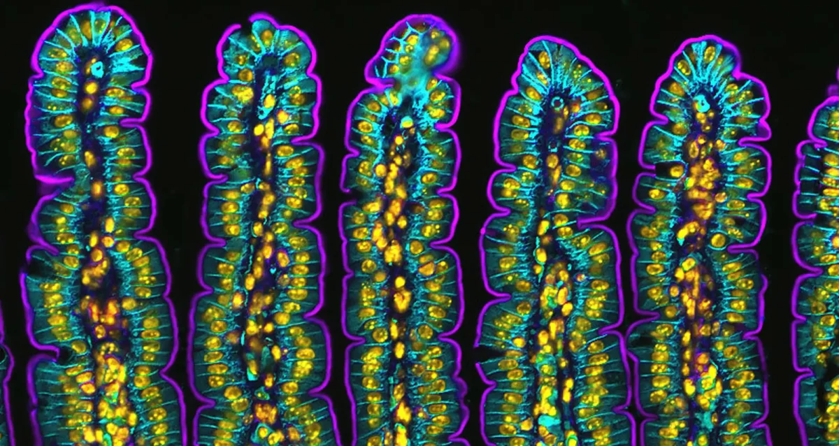 A fluorescent micrograph of a section of small intestine of a mouse. Image courtesy of Amy Engevik, Medical University of South Carolina.