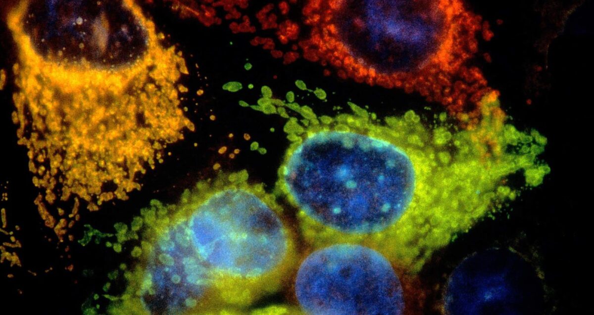 Micrograph of mouse keratinocytes. Image courtesy of Nancy Kedersha, ImmunoGen, Inc.