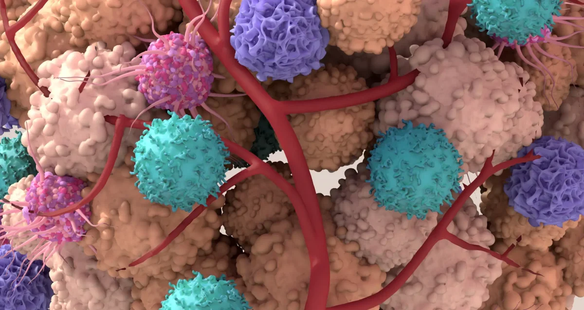 Tumor microenvironment illustration - shutterstock
