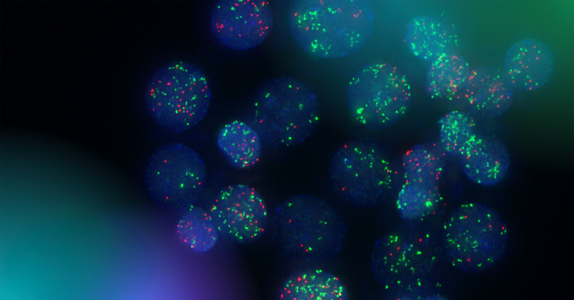 The Chavez lab uses fluorescent markers to observe circular extra-chromosomal DNA elements floating in cancer cells. Research has shown that these fragments of DNA are abundant in solid pediatric tumors and associated with poor clinical outcomes. Image credit: Lukas Chavez, Sanford Burnham Prebys.