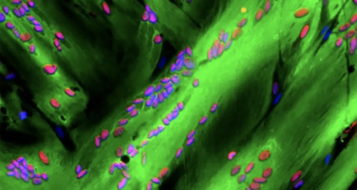 Myogenic determination gene number 1 (MYOD) protein immunofluorescence in myofibers.
