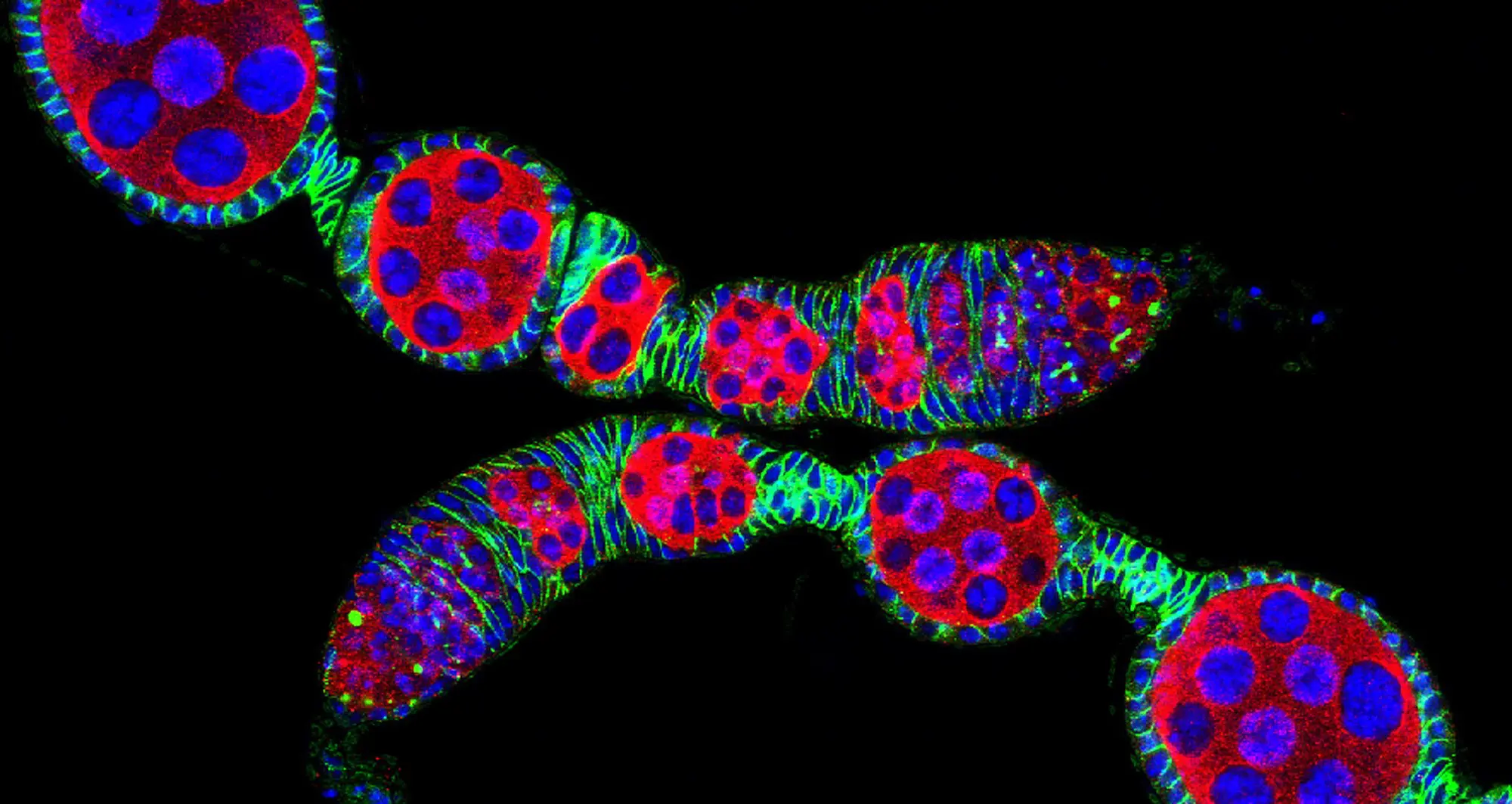 A confocal micrograph of Drosophila (fruit fly) ovirioles. Image courtesy of National Institutes of Health.
