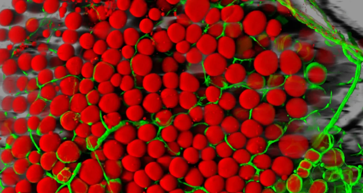 colorized scanning electron micrograph of mouse fat cells (red) surrounded by a network of blood vessels (green). Image courtesy of Daniel Malide, National Heart, Lung and Blood Institute, NIH.