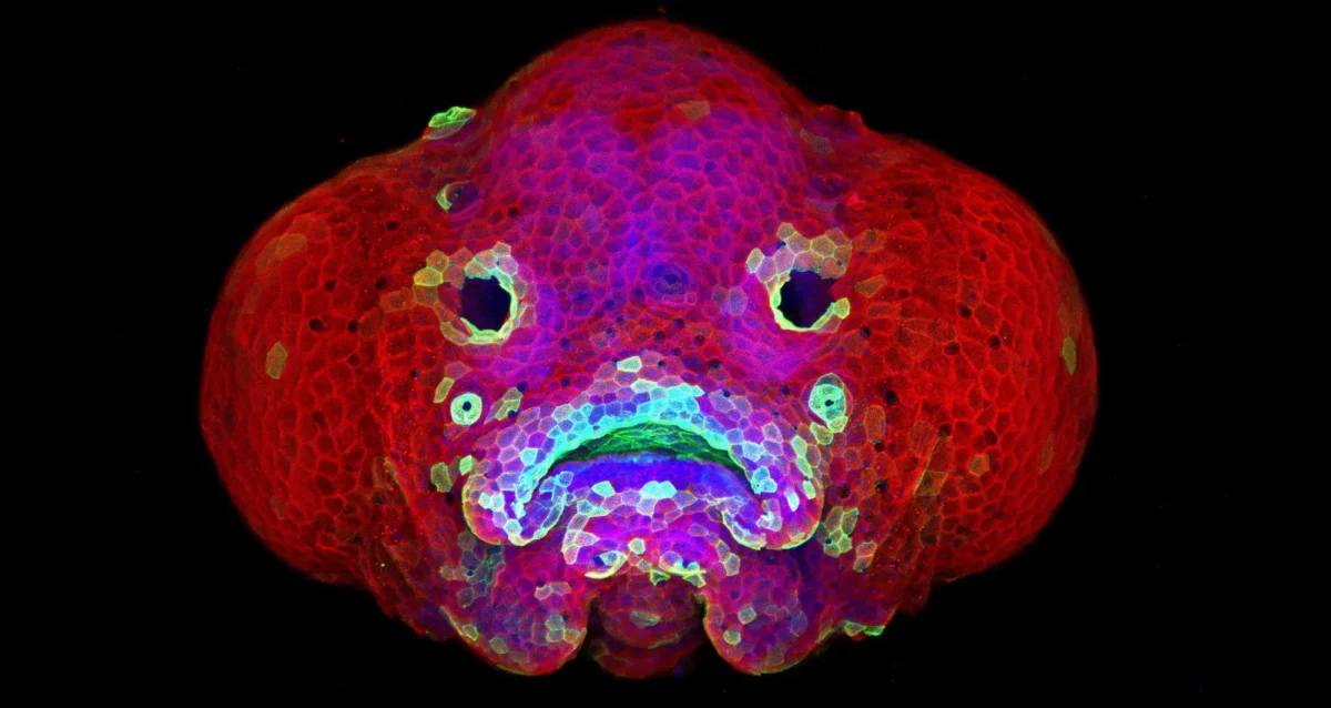 zebrafish larva. Image courtesy of Oscar Ruiz and George Eisenhoffer, University of Texas MD Anderson Cancer Center