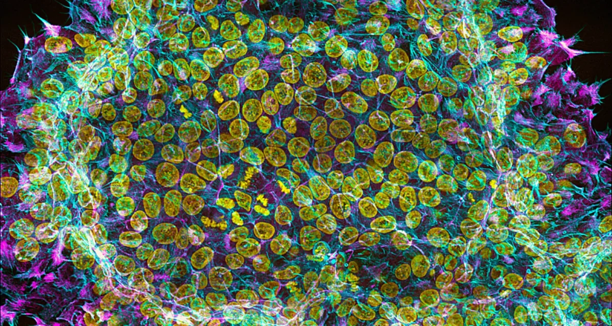 Human embryonic stem cell colony. Image courtesy of Nilay Taneja, Vanderbilt University.