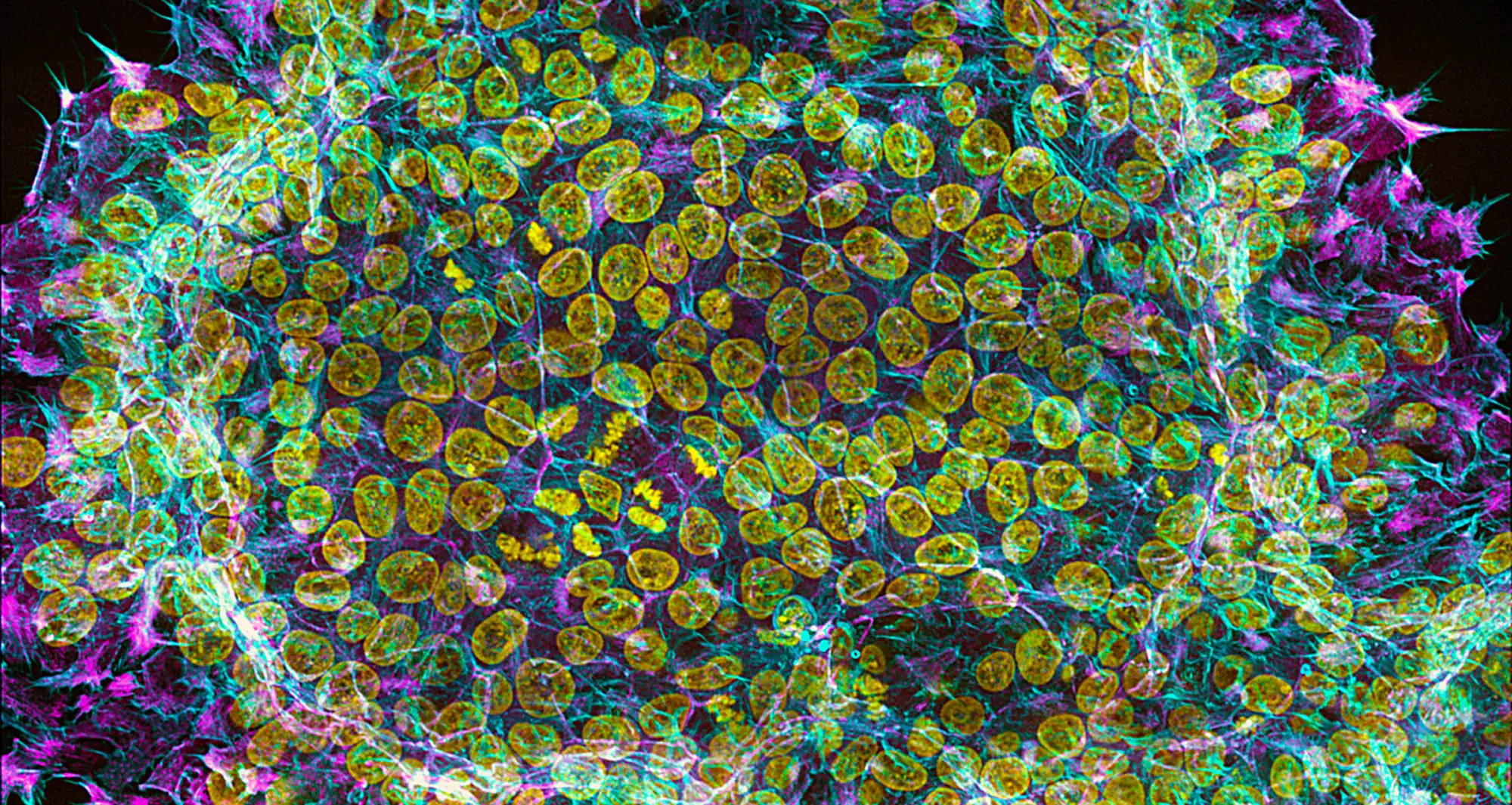 Human embryonic stem cell colony. Image courtesy of Nilay Taneja, Vanderbilt University.