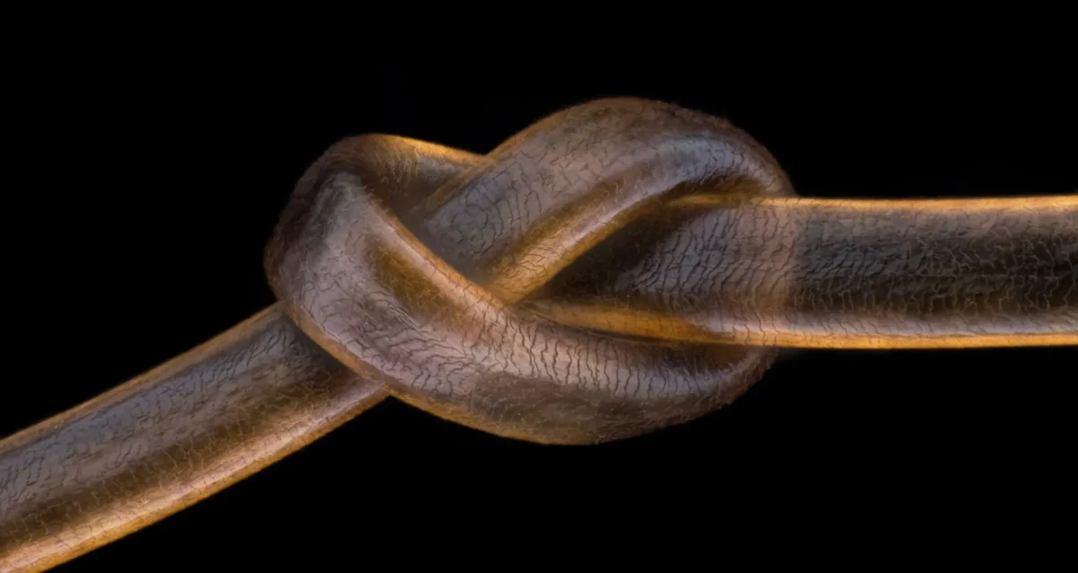 Strand of human hair. Image courtesy of Robert Vierthaler, Pfarrwerfen, Salzburg, Austria.