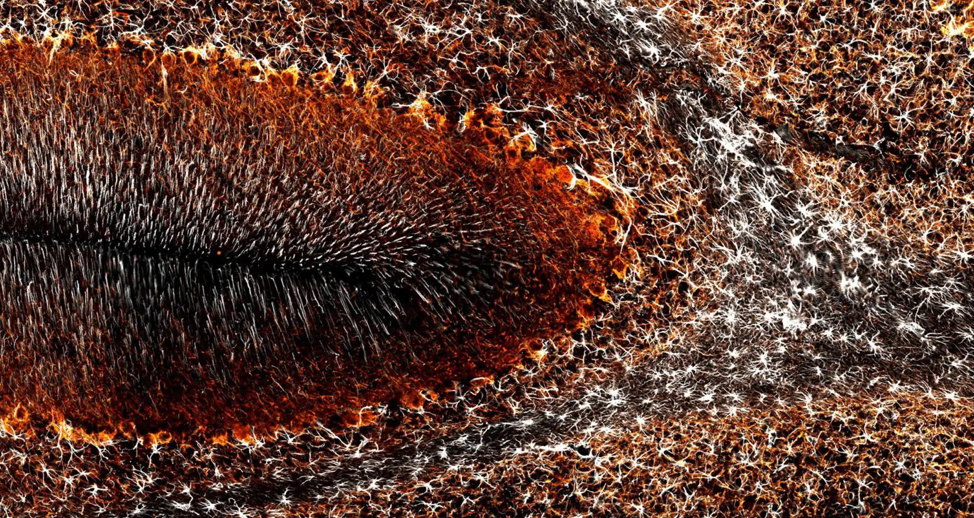 cerebellum of a rat brain. Image courtesy of Barbara Orsolits, Semmelweis University, Budapest, Hungary