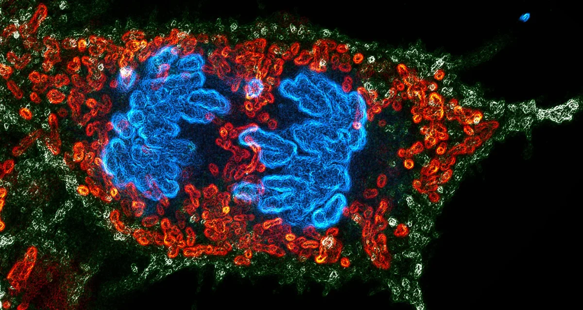micrograph depicting a dividing embryonic human kidney cell. Image courtesy of Sayantan Datta.