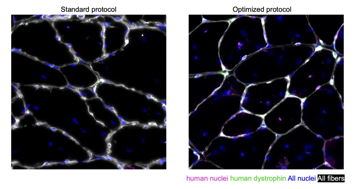 Human muscle cells derived from the Caputo et al. optimized protocol efficiently regenerate muscle tissue