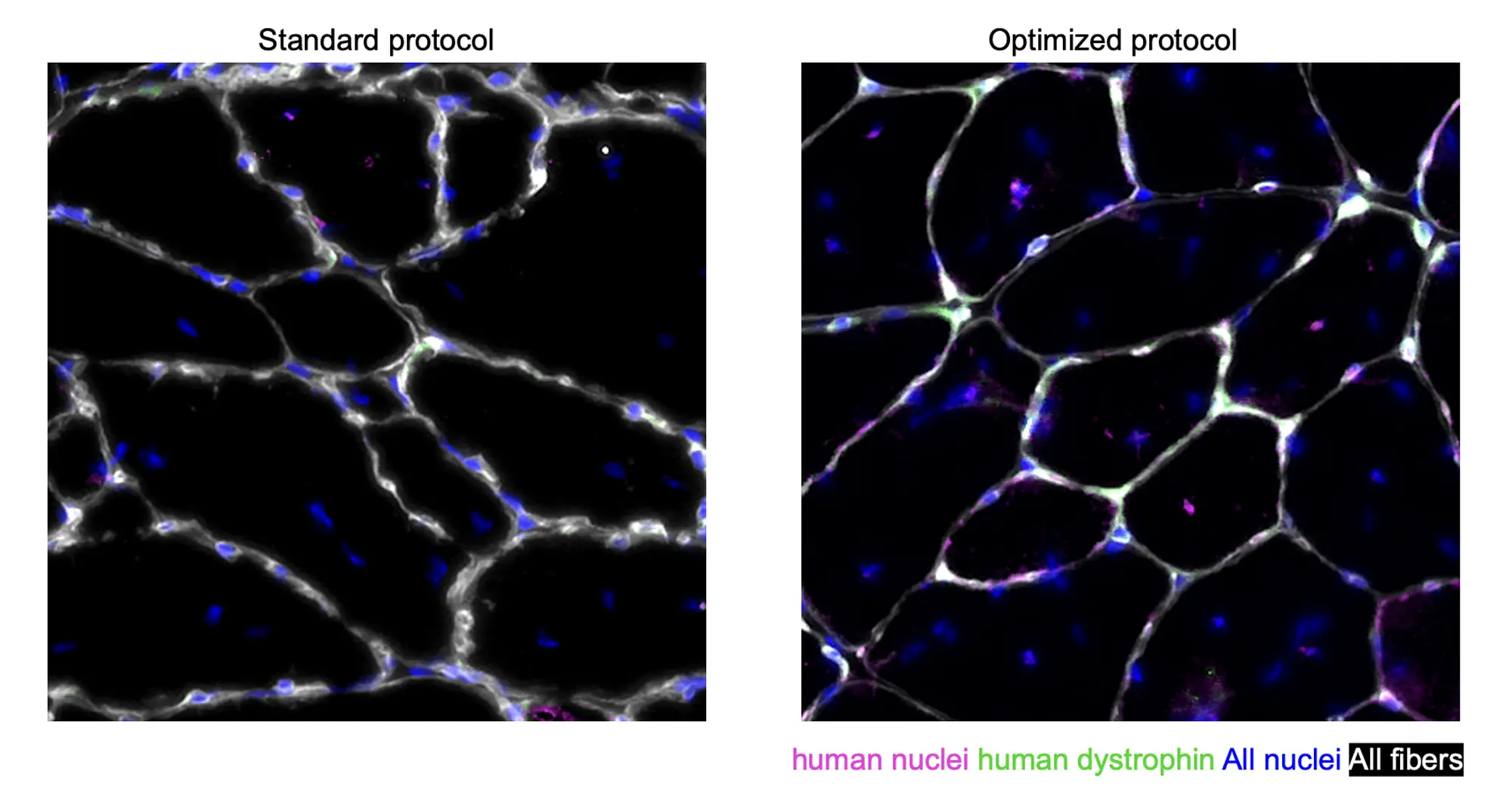 Human muscle cells derived from the Caputo et al. optimized protocol efficiently regenerate muscle tissue