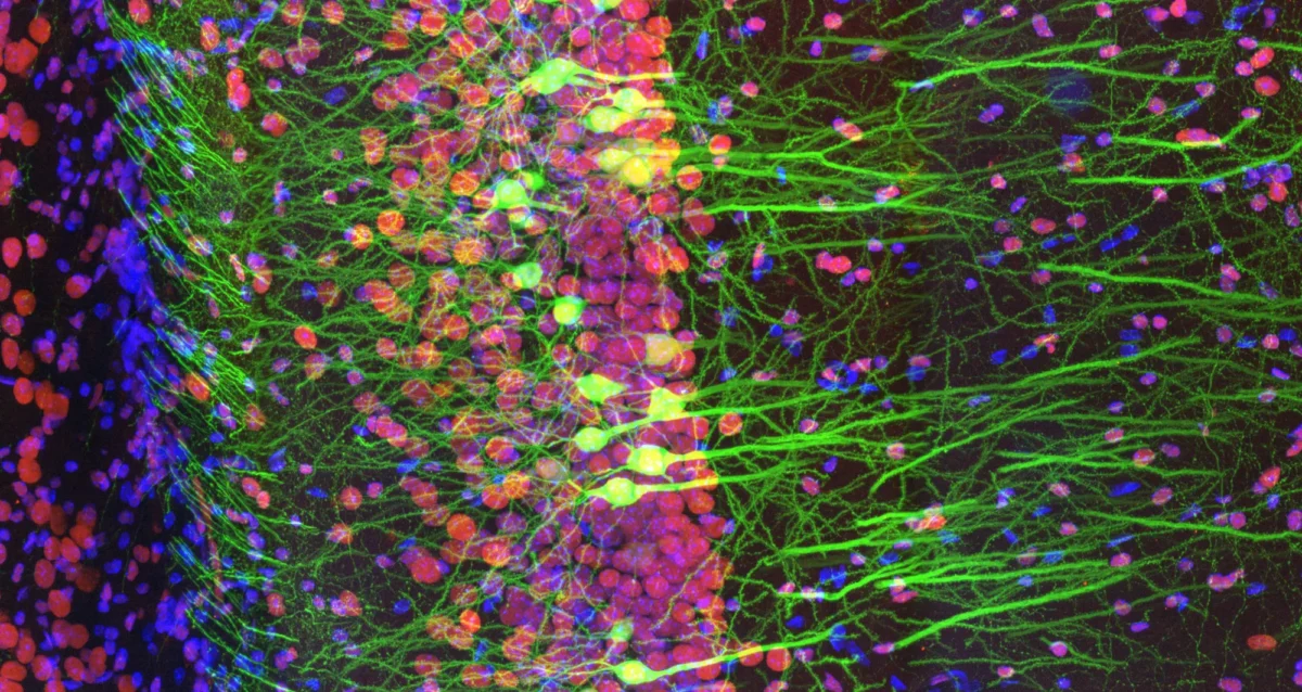 stained fluorescence image of a slice of mouse brain, green depicts the excitatory hippocampal neurons; red are obesity-associated proteins and cell nuclei in blue. Image courtesy of Ainara Pintor