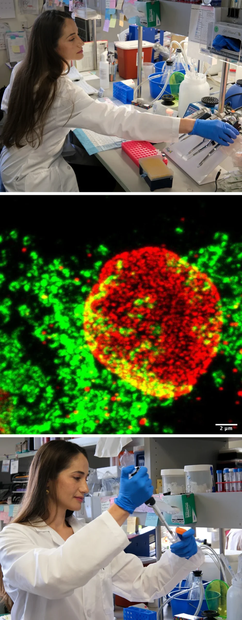 Dana Mamriev collage. Image credit Sanford Burnham Prebys