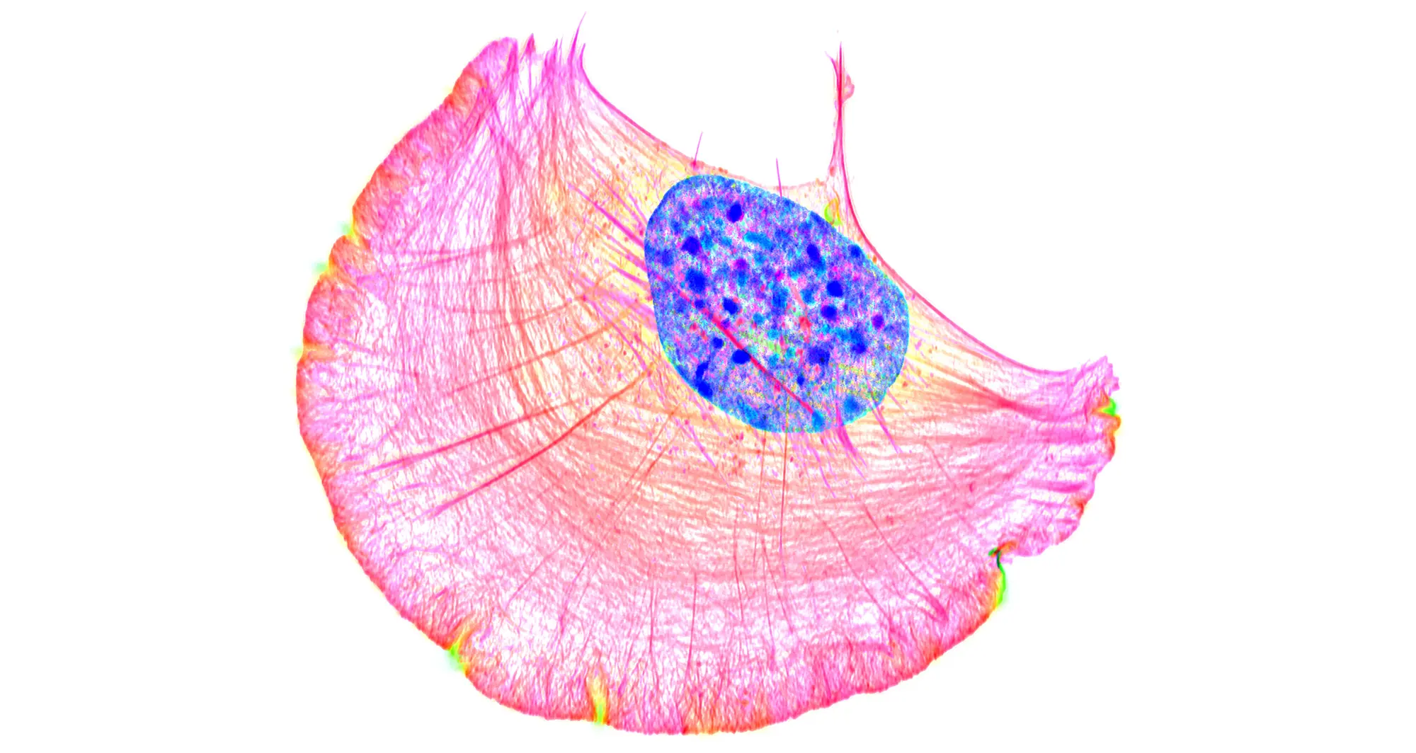 Cell crawling. Image courtesy of Dylan T. Burnette, Vanderbilt University.