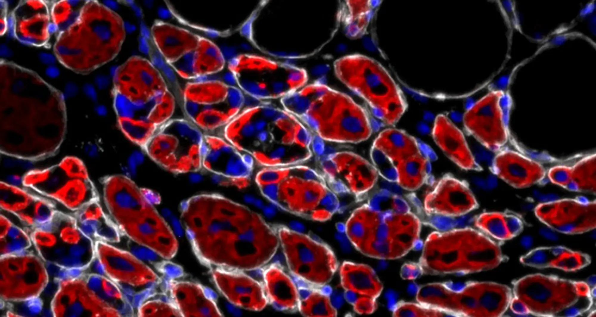 Regenerating muscle. Image credit: Alessandra Sacco, Lale Cecchini, Sanford Burnham Prebys.