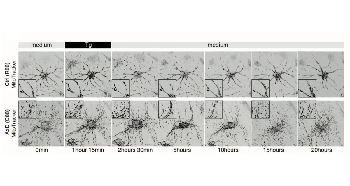 Scientists demonstrated that glial fibrillary acidic protein (GFAP) promotes mitochondrial fission rather than blocking fusion. The genetic disorder Alexander disease is caused by mutations in the gene housing the instructions for GFAP.