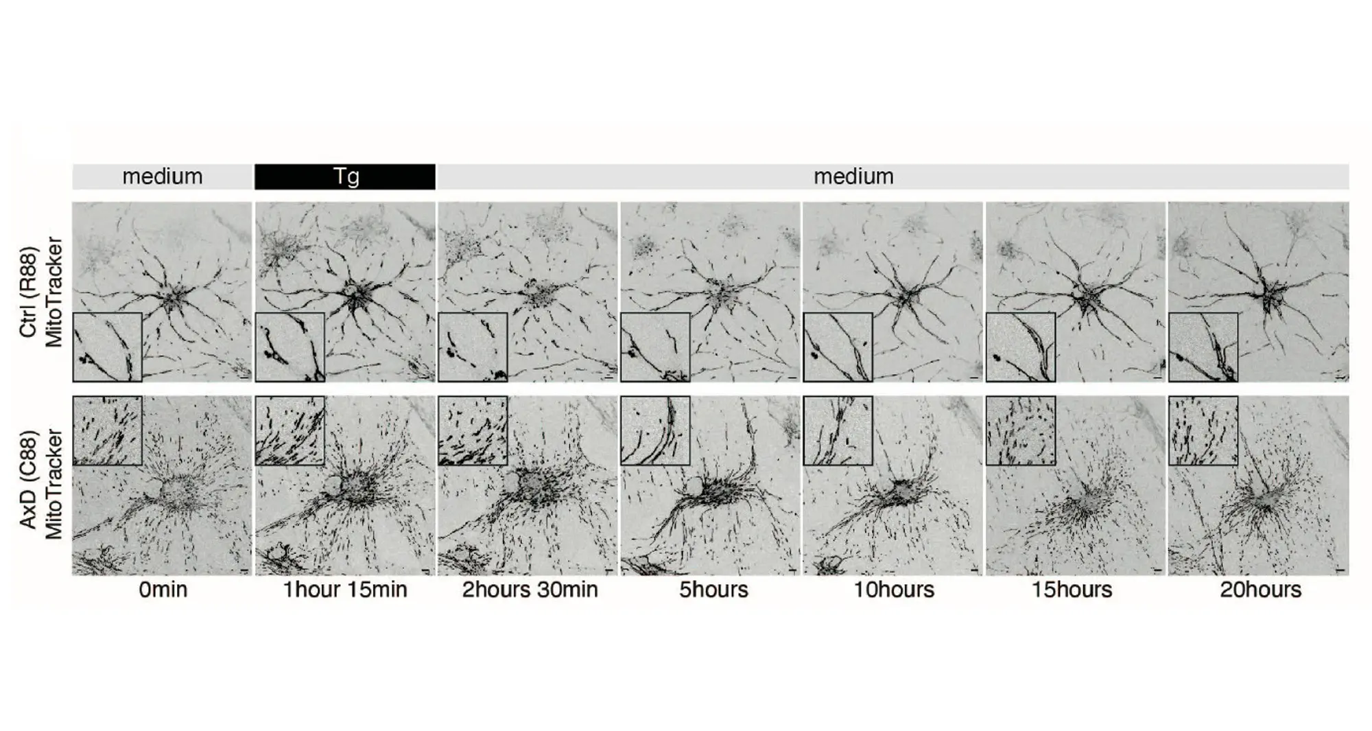 Scientists demonstrated that glial fibrillary acidic protein (GFAP) promotes mitochondrial fission rather than blocking fusion. The genetic disorder Alexander disease is caused by mutations in the gene housing the instructions for GFAP.