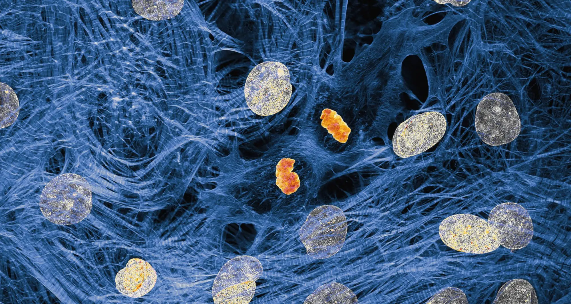 cardiac myocytes. Image courtesy of James Hayes, Vanderbilt University.