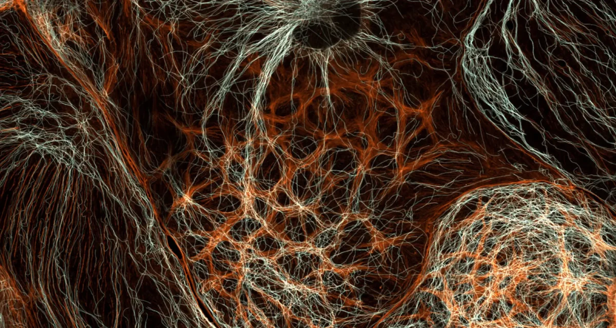 micrograph of rat liver cells, actin is shown in orange and tubulin in white. Image courtesy of Francisco Lázaro-Diéguez, Albert Einstein College of Medicine