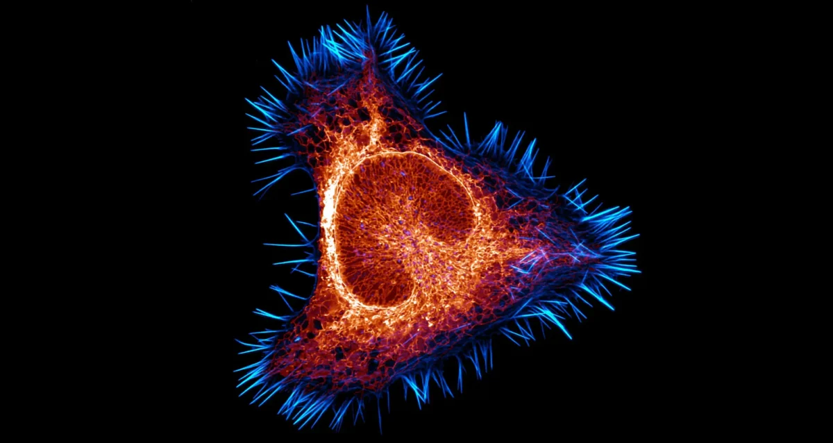 endoplasmic reticulum, the largest organelle in most cells, is depicted in this mouse brain cancer cell. The actin cytoskeleton in cyan and the endoplasmic reticulum in red. Image courtesy of Halli Lindamood and Eric Vitriol, Augusta University.
