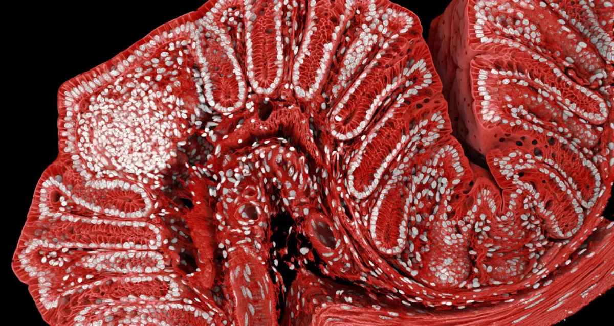 confocal micrograph of fluorescently marked mouse colon. Image courtesy of Marius Mählen, Koen Oost, Prisca Liberali and Laurent Gelman, Friedrich Miescher Institute for Biomedical Research, Basel, Switzerland.