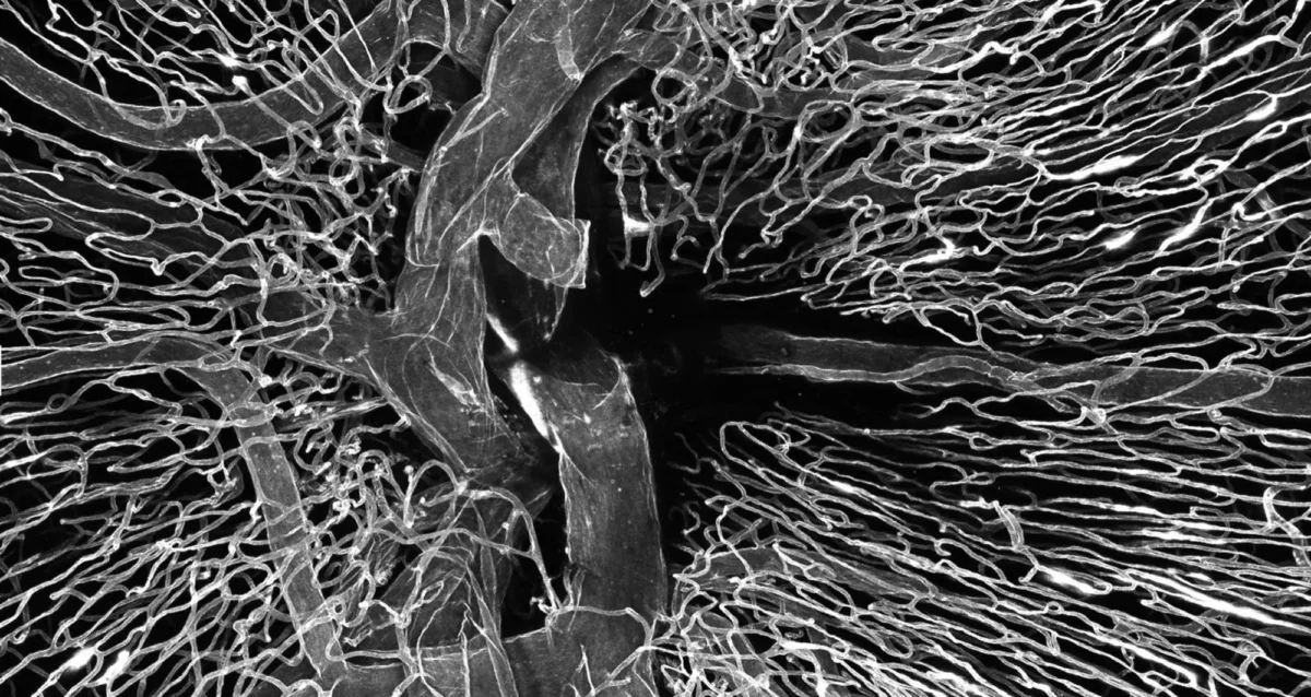 A human donor central retinal artery was cannulated (intubated) and perfused with Lectin FITC, a specific protein chemically linked to a Image courtesy of Dong An, Lions Eye Institute, Australia.