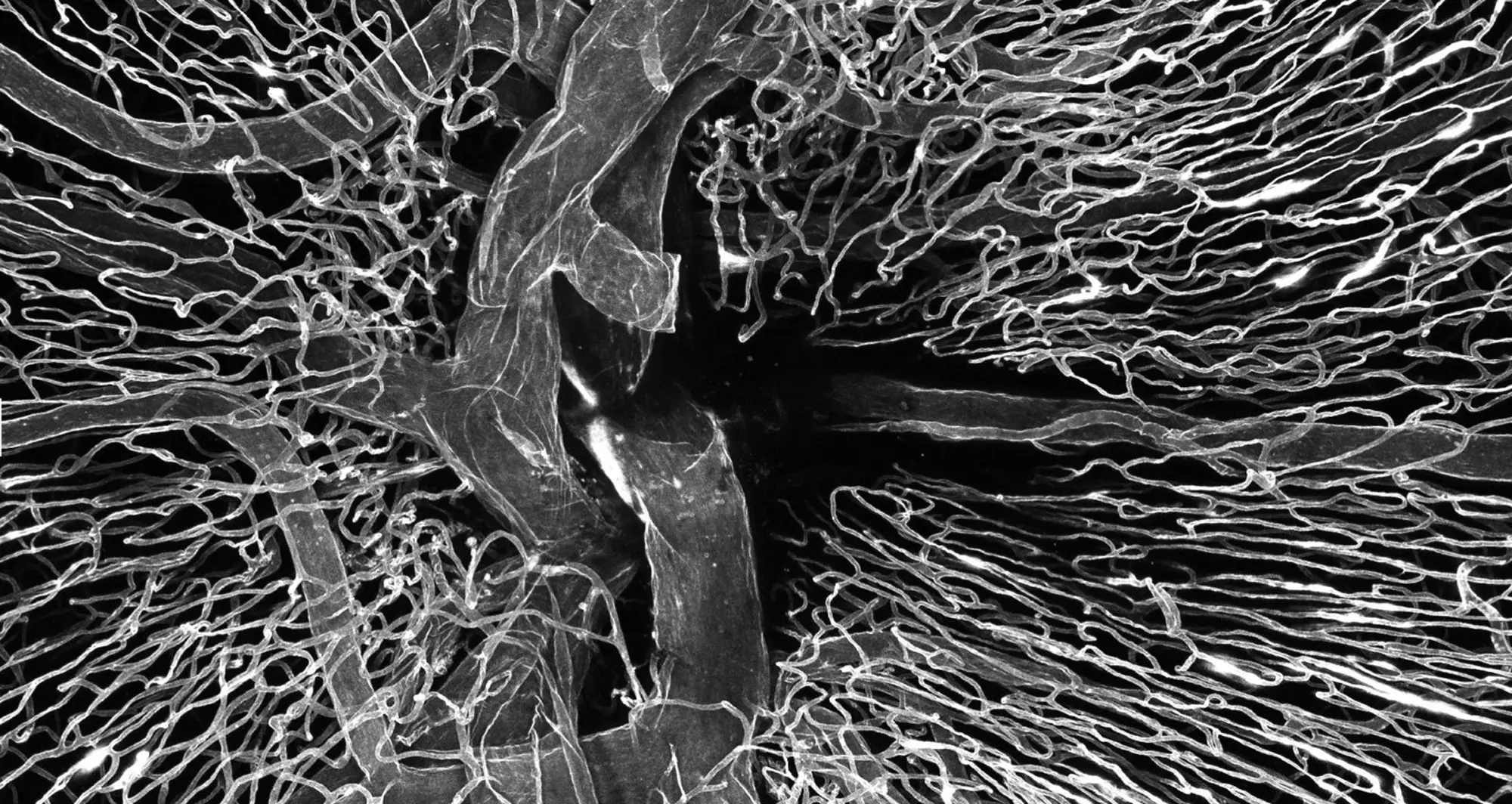 A human donor central retinal artery was cannulated (intubated) and perfused with Lectin FITC, a specific protein chemically linked to a Image courtesy of Dong An, Lions Eye Institute, Australia.