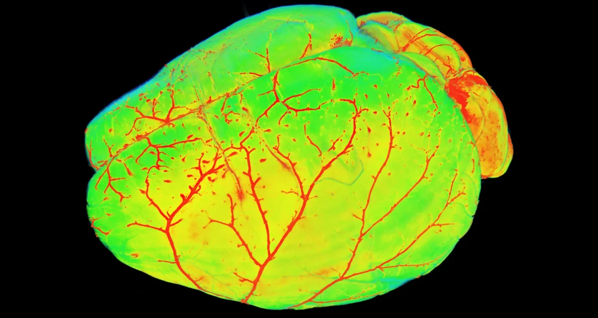 Mouse brain vasculature, as imaged by light sheet fluorescence microscopy. Image courtesy of Ali Erturk, Munich, Germany.