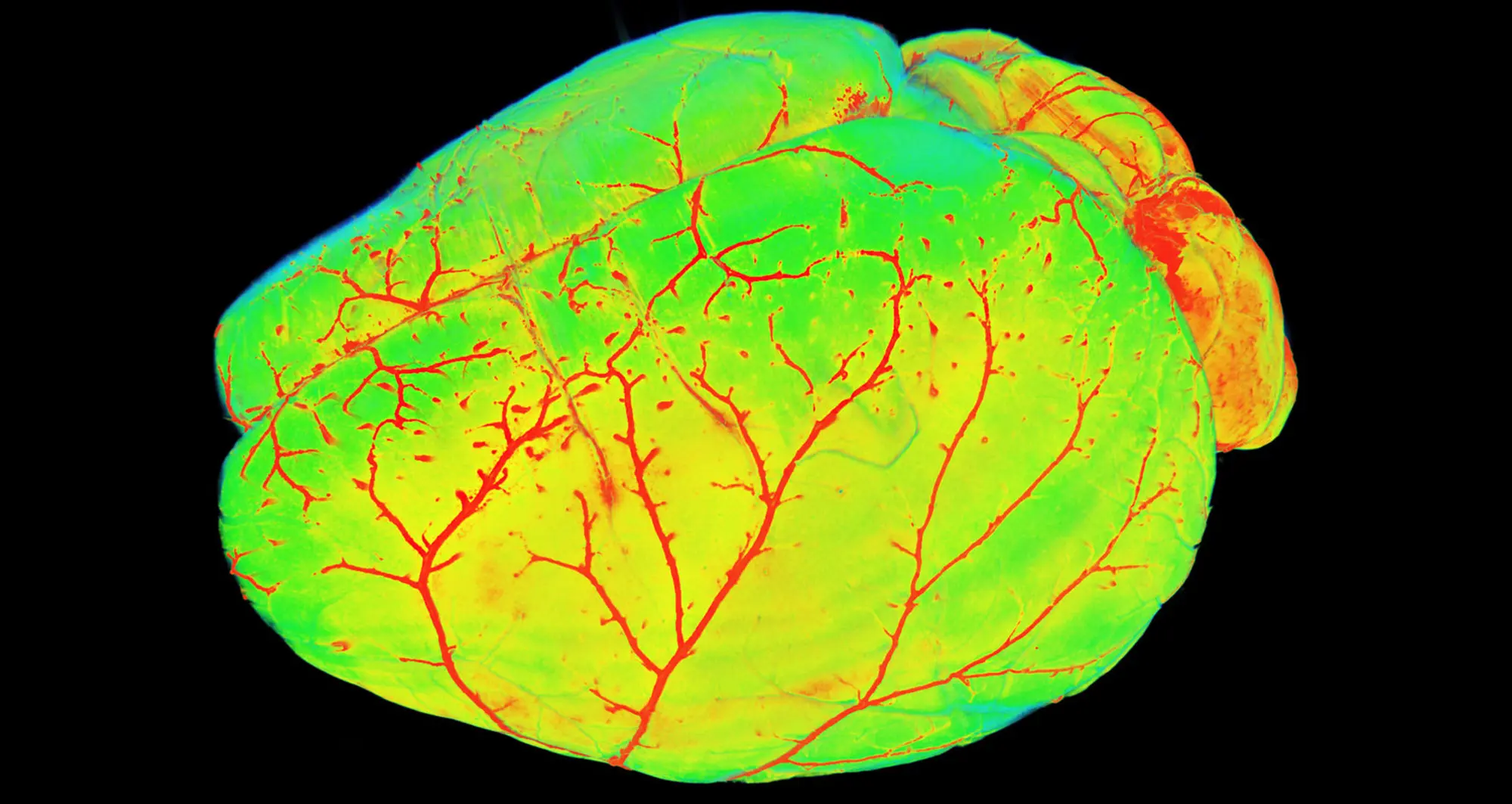 Mouse brain vasculature, as imaged by light sheet fluorescence microscopy. Image courtesy of Ali Erturk, Munich, Germany.