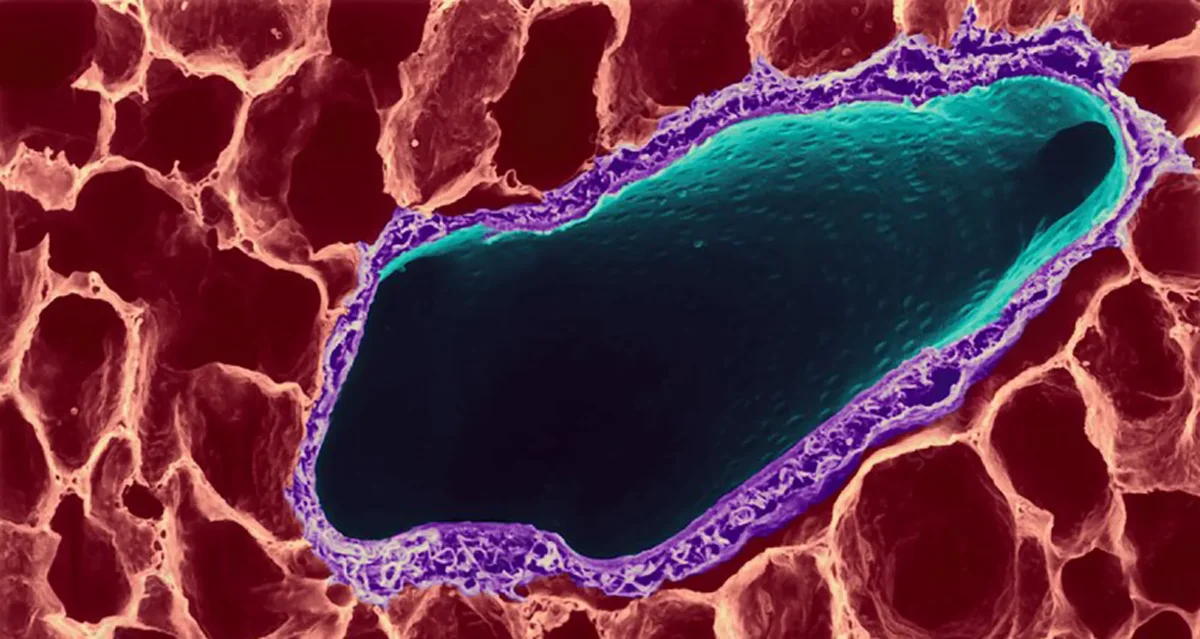 Colorized scanning electron micrograph of human lung tissue, depicting alveoli and bronchus. Lung alveoli are tiny, grape-like sacs, numbering in the millions, where essential gas exchange (oxygen/carbon dioxide) occurs. Image courtesy of Dennis Kunkel/SPL.