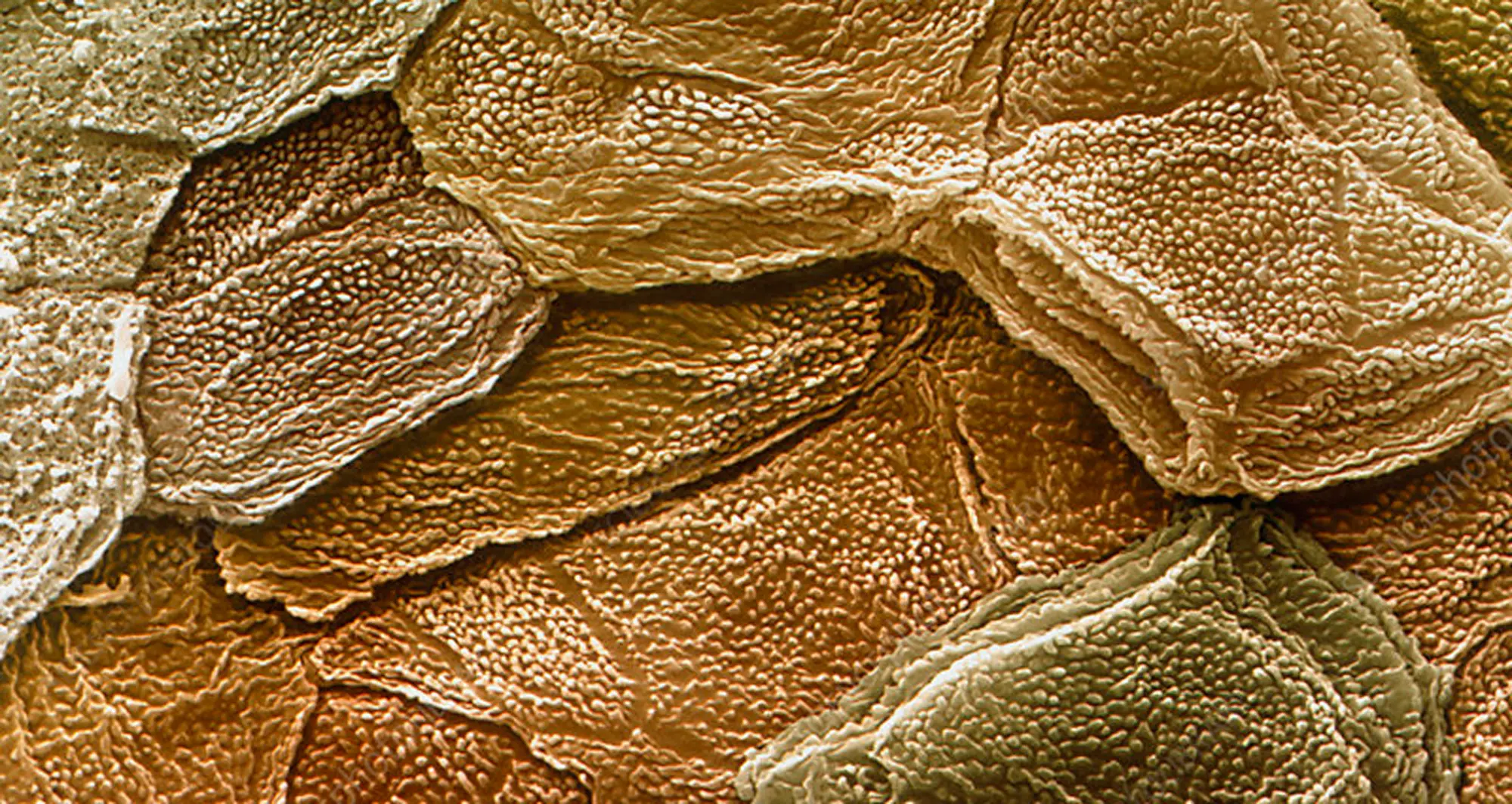 Colorized scanning electron micrograph of surface of human skin. The outermost layer of skin is called the stratum corneum and is composed primarily of keratinocytes, living and dead. Dead cells form horny scales, and release peptides called defensins, which are part of the first line of immune defense mechanisms. Eye of Science/SPL
