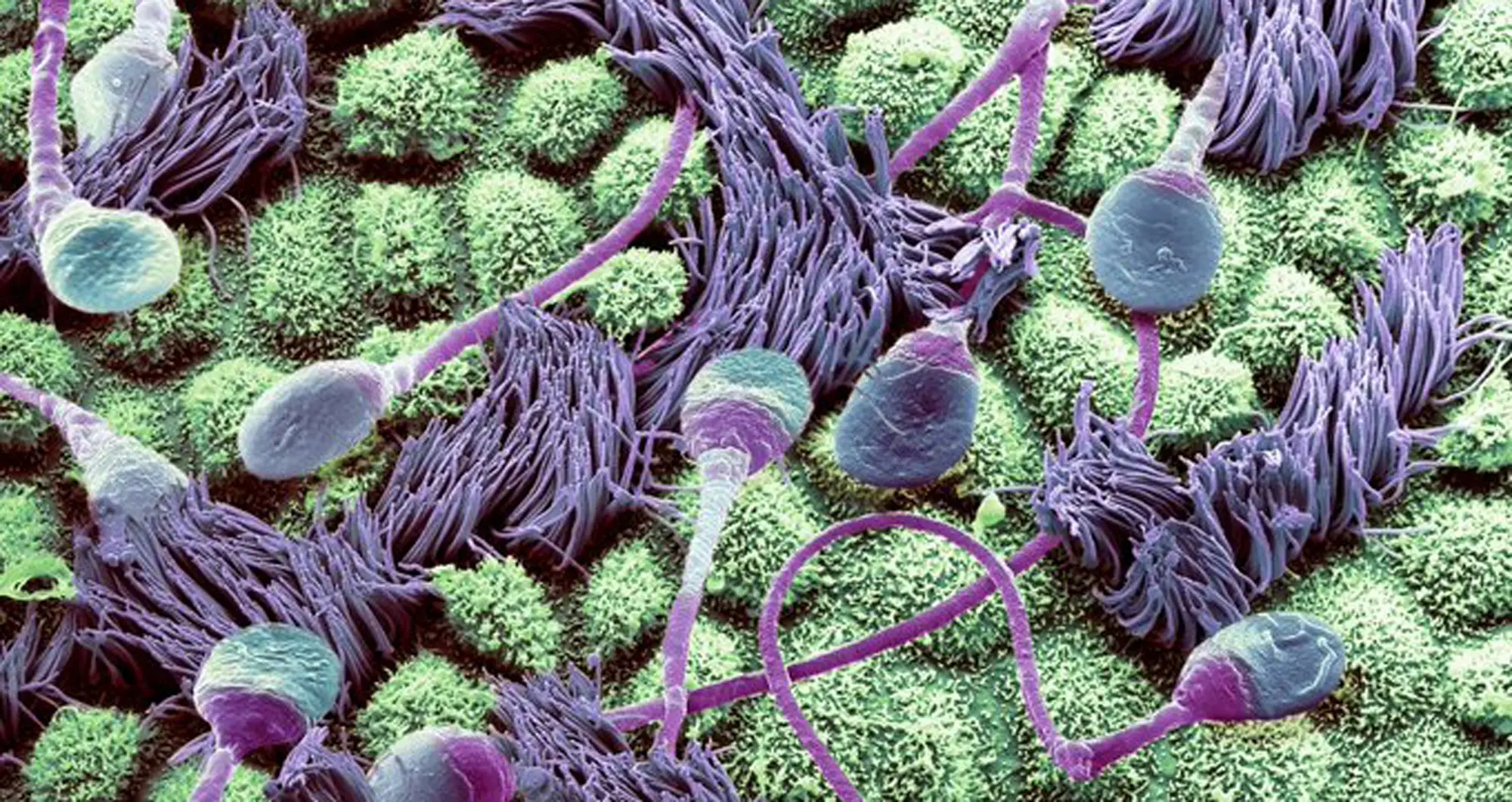 Colorized scanning electron microscope composition of human sperm traveling through a fallopian tube. Image courtesy of Steve Gschmeissner/Getty.