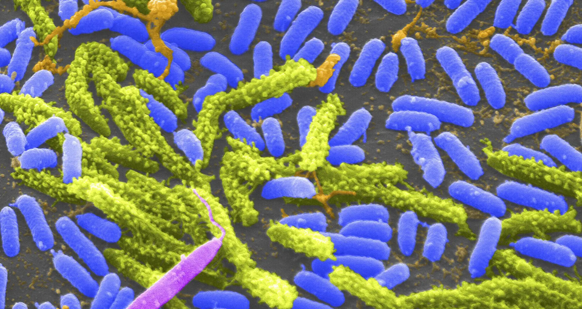 Colorized scanning electron micrograph of Vibrio bacteria