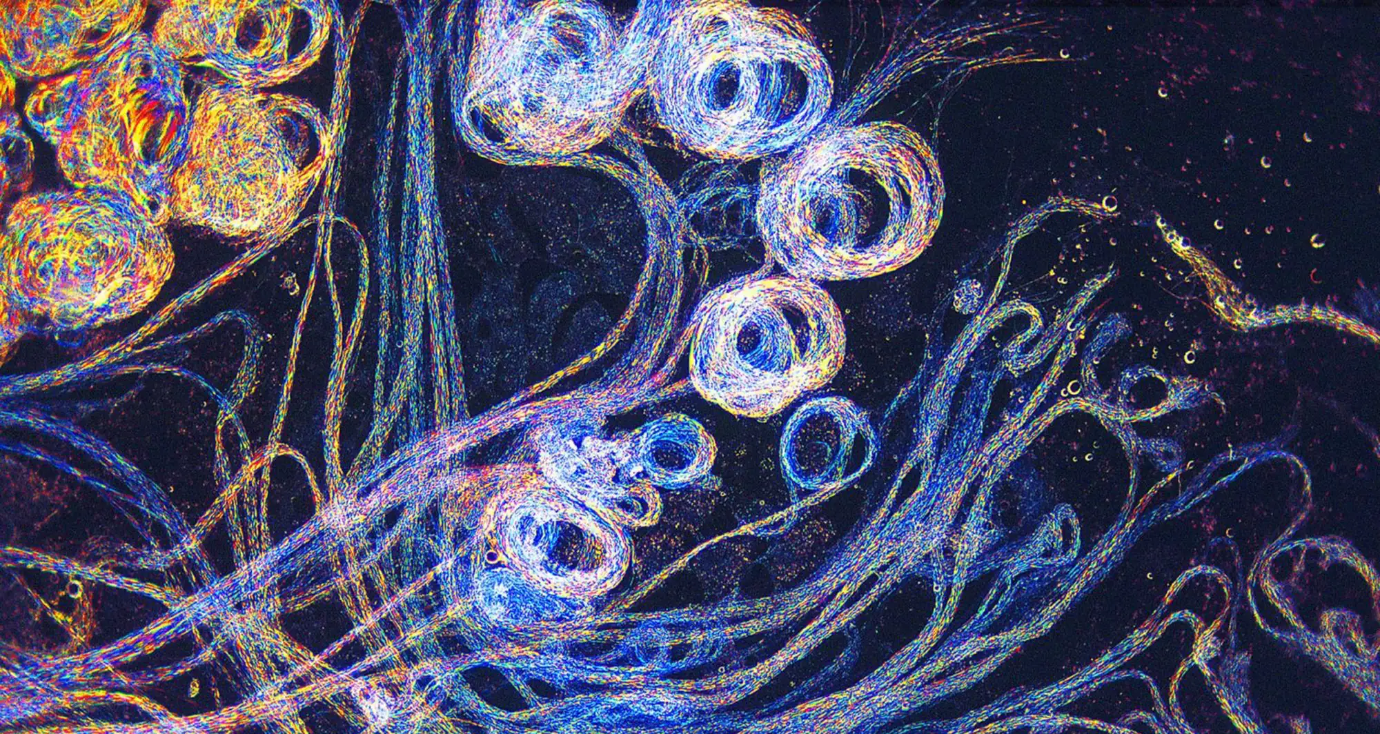 Darkfield microscopy captures the flowing grace of sperm from Drosophila virilus, a species of fruit fly. Image courtesy of Earl Nishiguchi.