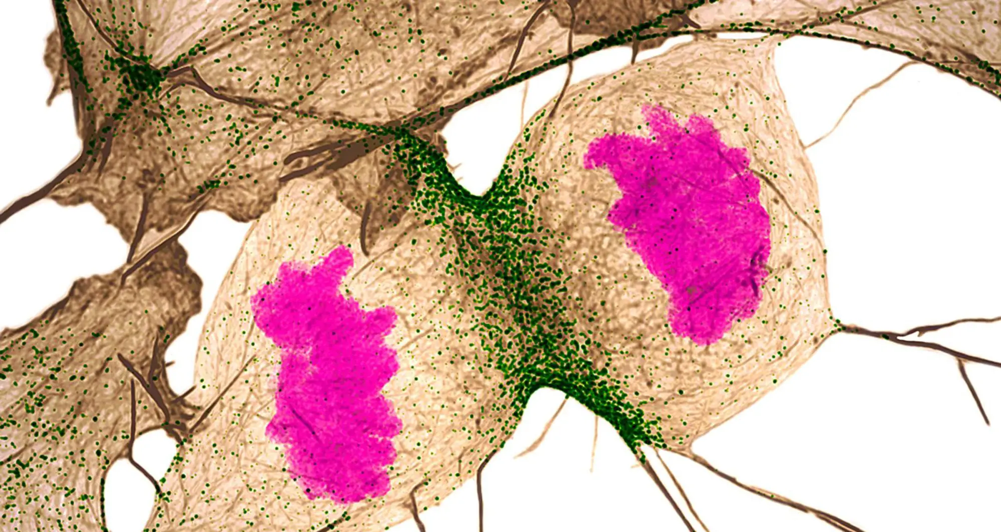 A human fibroblast. Image courtesy of Nilay Taneja.