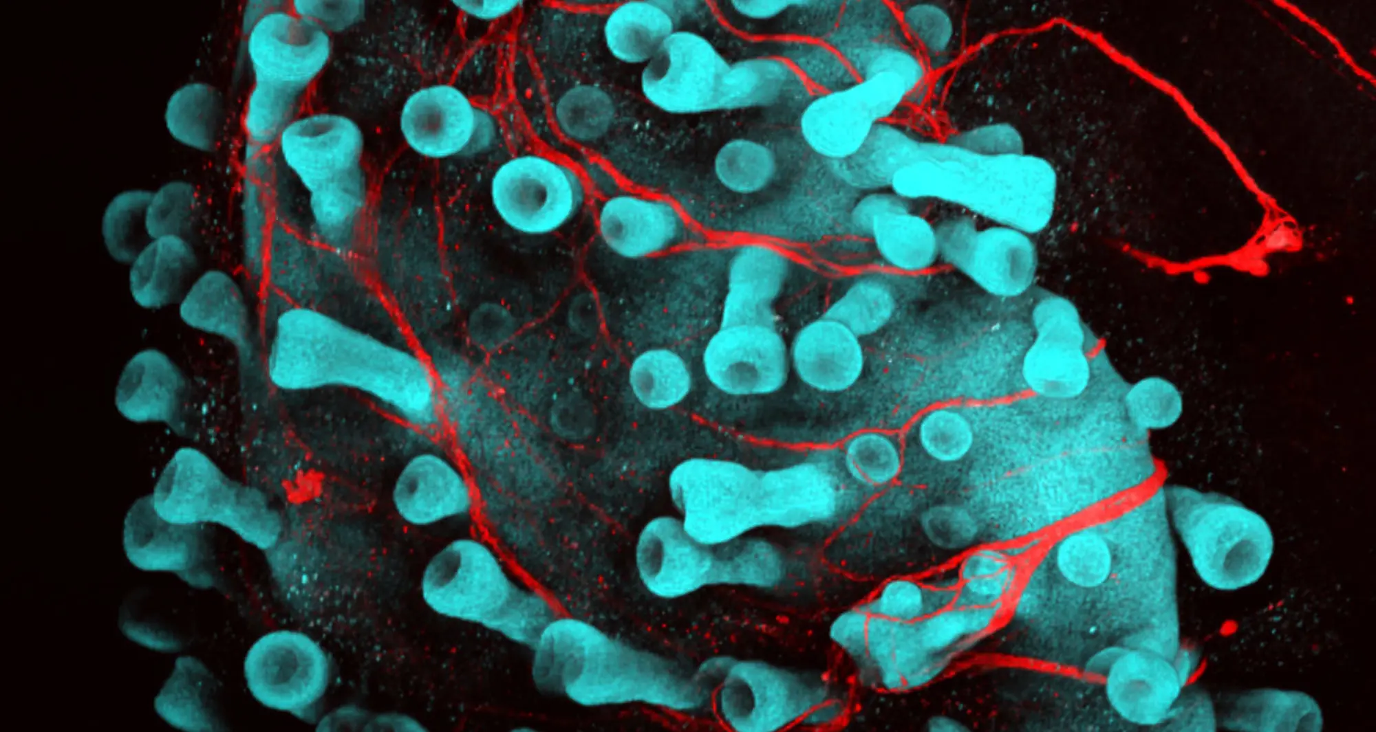 Confocal microscopy reveals human hair follicles growing from a stem cell-derived organoid (cyan) with nerves (red). Image courtesy of Karl R. Koehler and Jiyoon Lee.