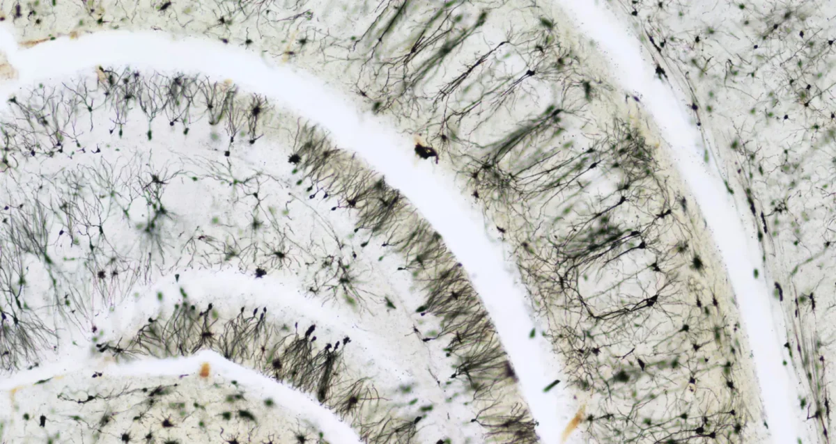 A micrograph depicts the hippocampal region of the human brain. Image courtesy of Sarah Moghadam and Ahmad Salehi.