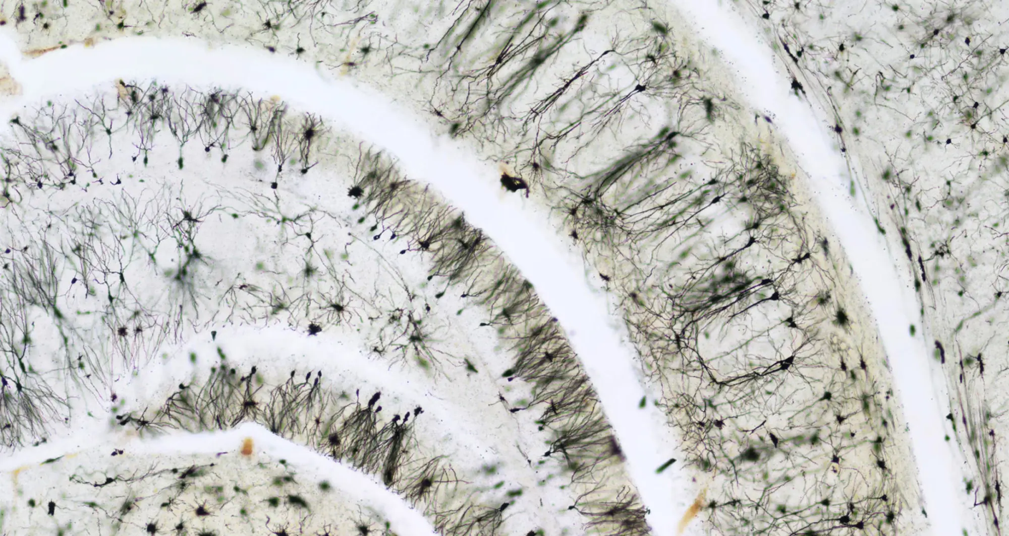 A micrograph depicts the hippocampal region of the human brain. Image courtesy of Sarah Moghadam and Ahmad Salehi.