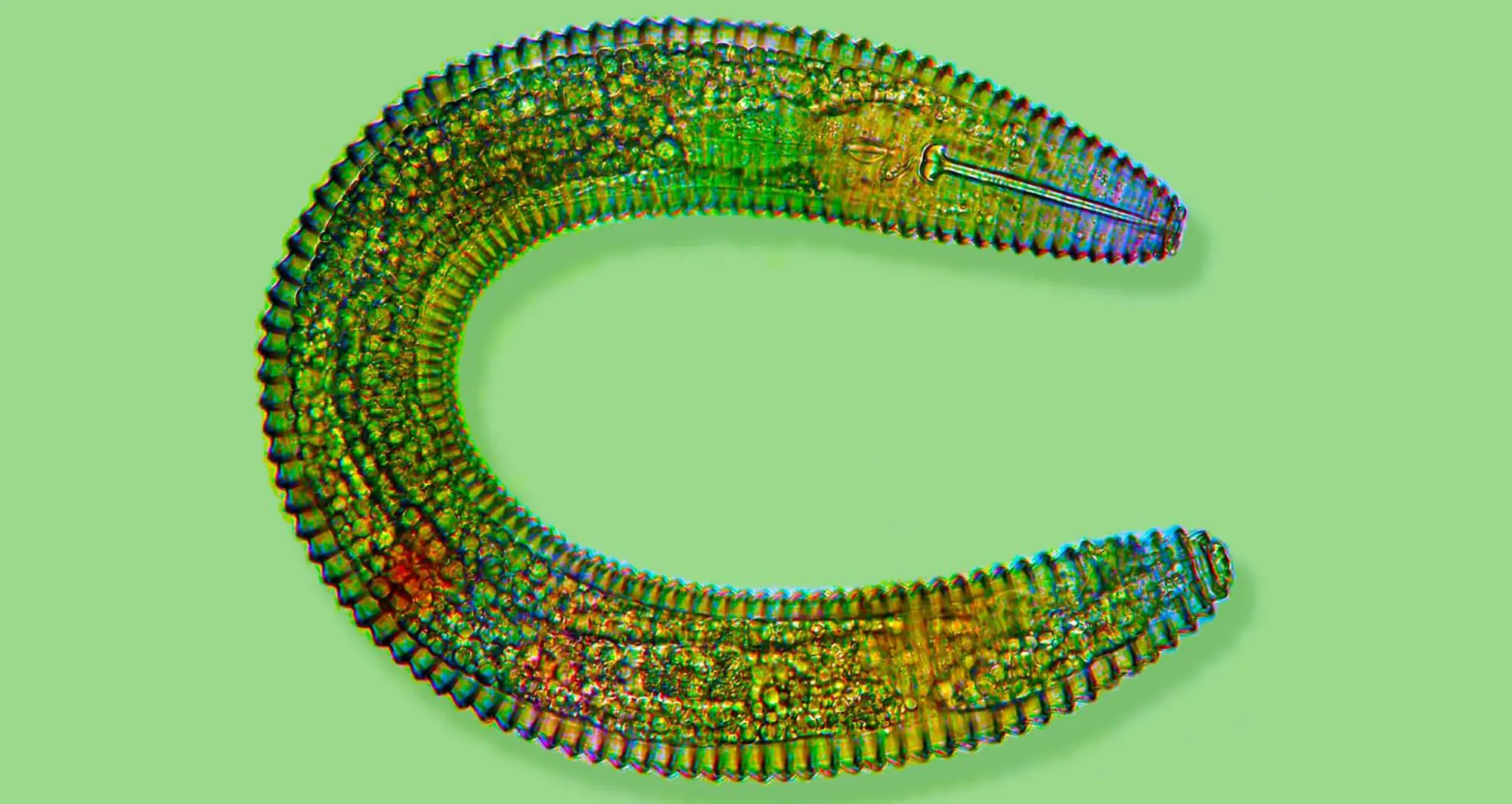 A ring nematode. Image courtesy of Jonathan Eisenback.