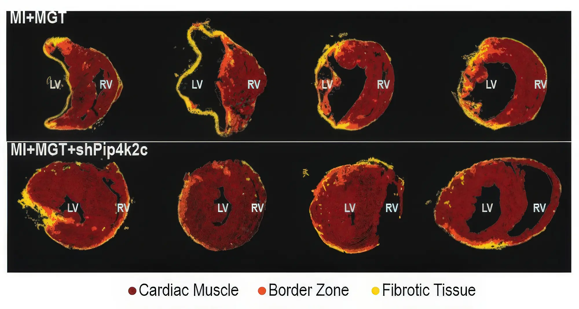 When the research team compared a combined treatment that blocked the PIP4K2C enzyme and prompted reprogramming in the hearts of mice to one that only initiated cellular reprogramming, the linked treatment (shown in the bottom row) was significantly more successful. Image credit: Alexandre Colas, Sanford Burnham Prebys.