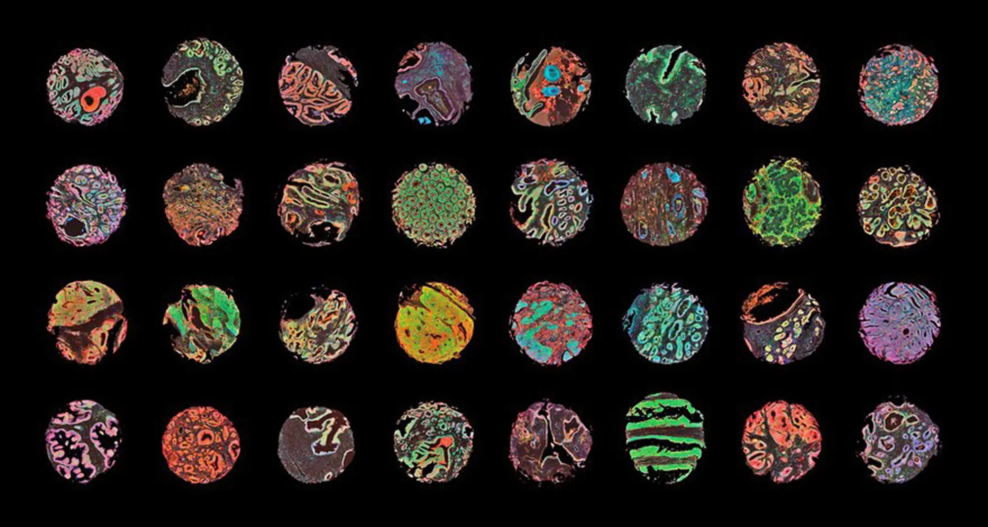 An array of human cancer tissues, including prostate, colon, kidney, intestine and breast, depicted in samples using fluorescence immunohistochemistry and confocal microscopy. Image courtesy of Wellcome Collection.