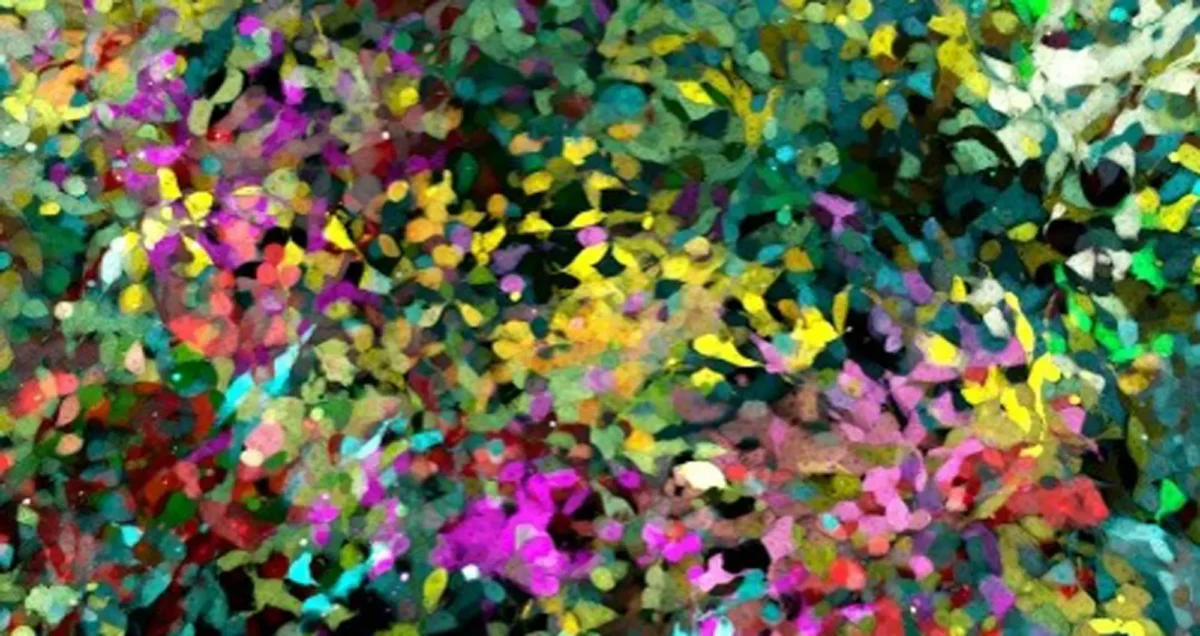 Connective tissue, colorfully illustrated with five different fluorescent proteins. Image courtesy of Daniela Malide, NIH.