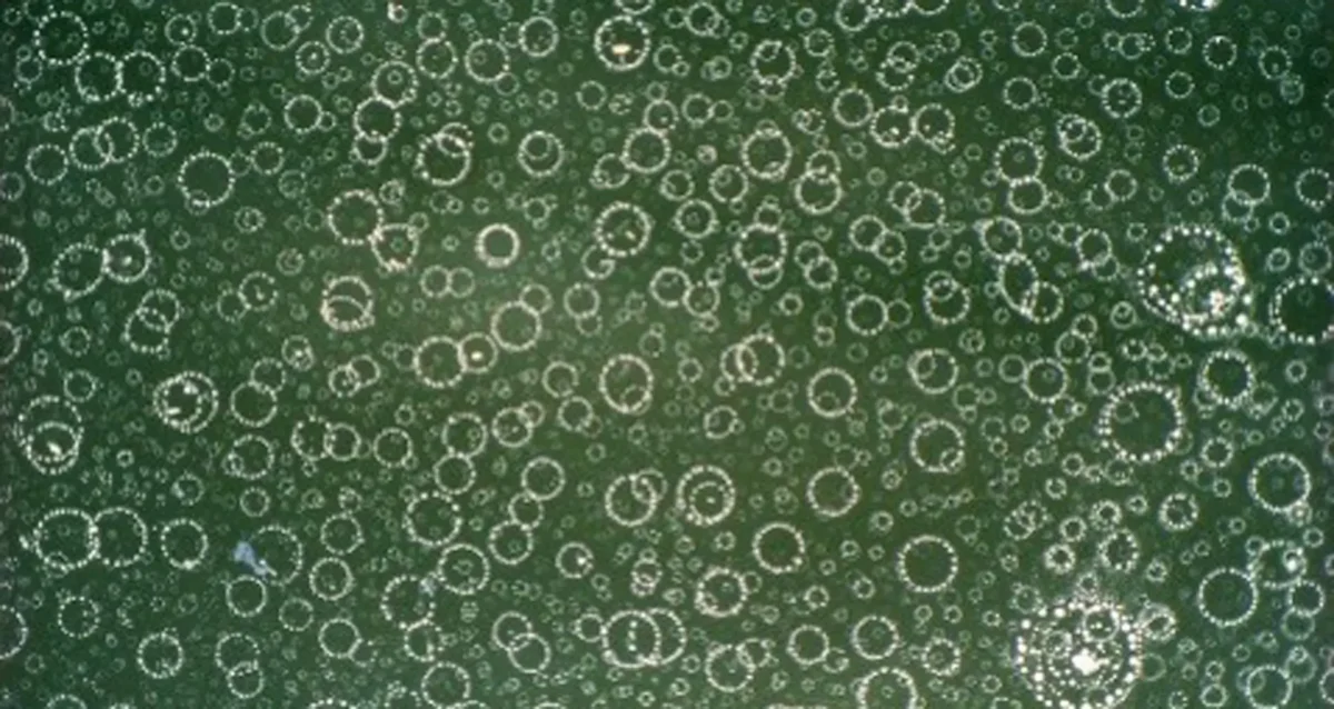 leukemia cells apoptosis. Image courtesy of Frank Abernathy