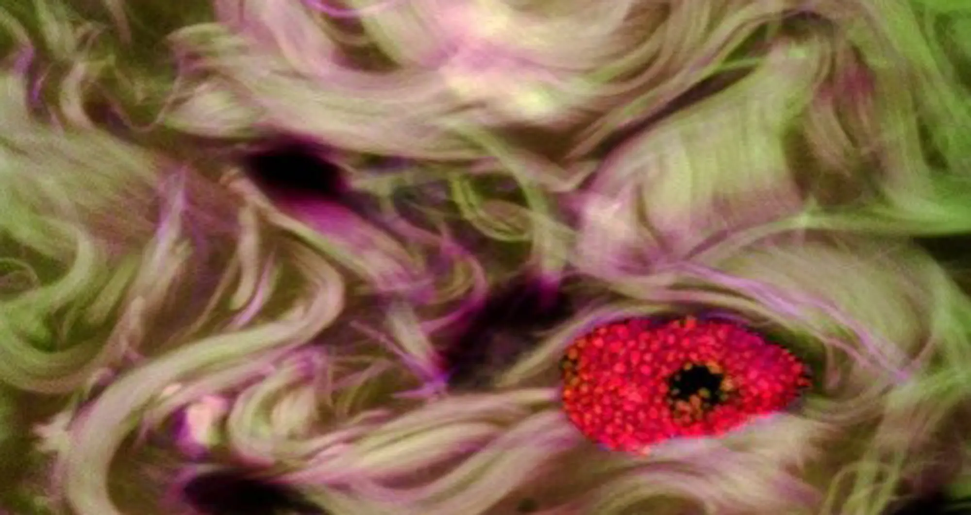 mast cell conjuctivitis. Image courtesy of Donald Pottle, The Schepens Eye Research Institute, Massachusetts.