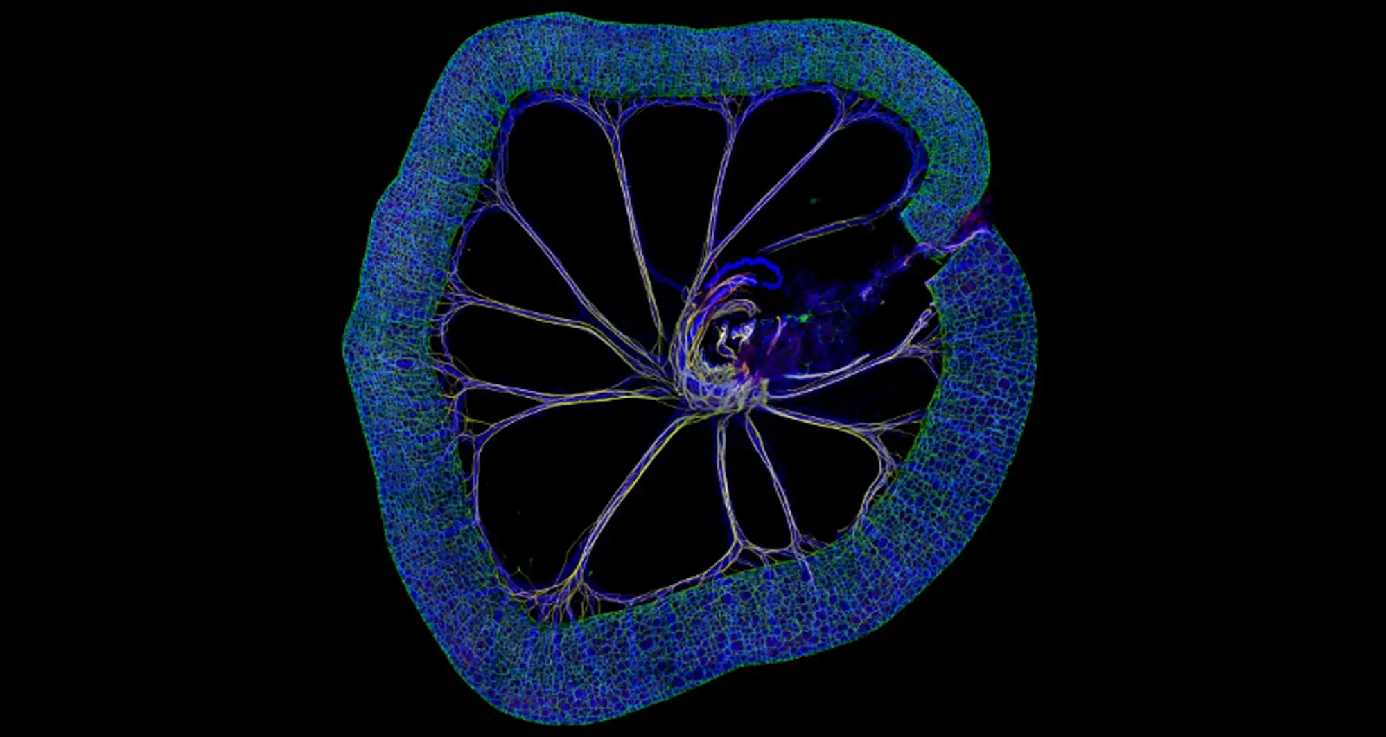 mouse small intestine. Image courtesy of John Hatch, National Heart, Lung and Blood Institute, NIH.