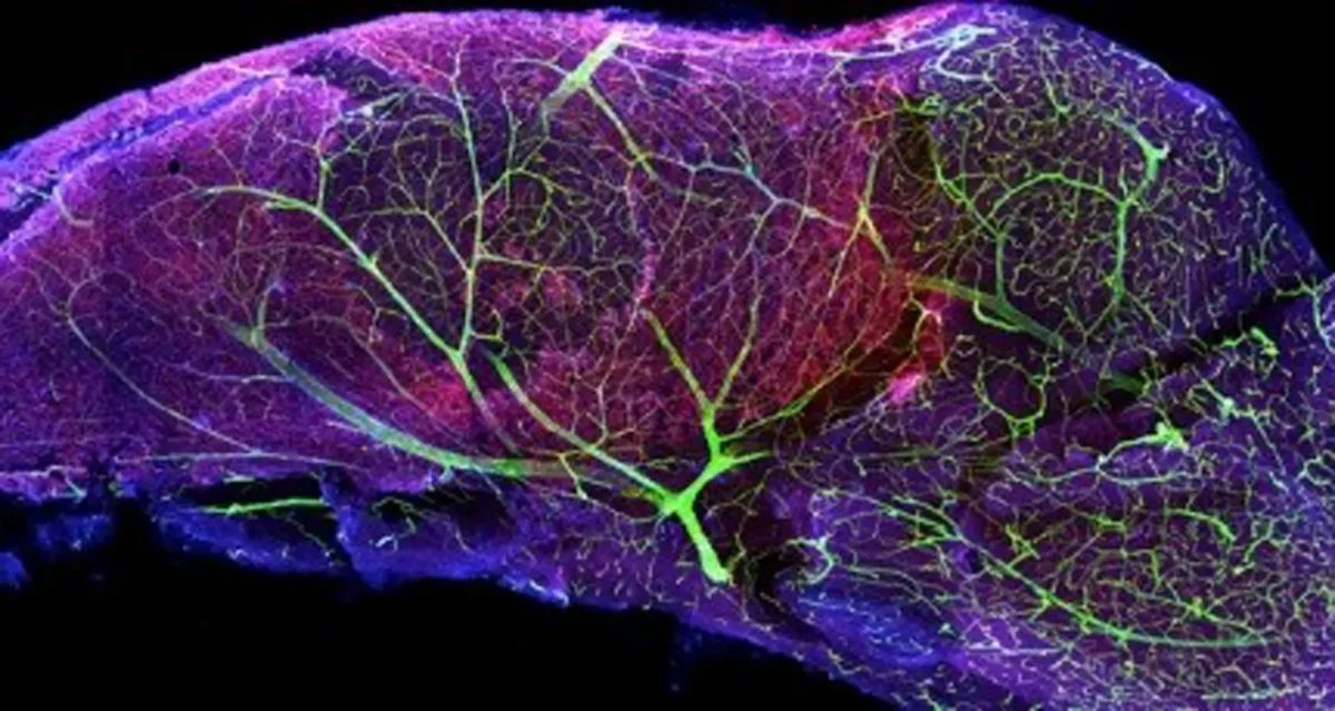 subventricular zone of a mouse brain. Image courtesy of Terry Burns, Stanford University.