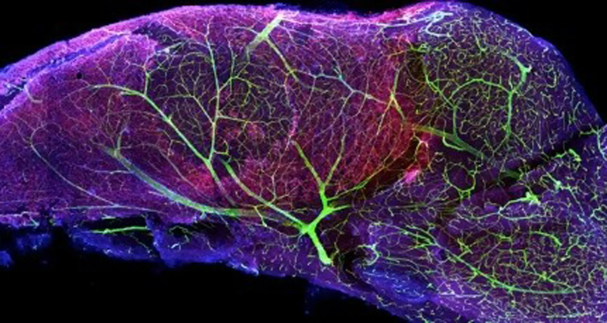 subventricular zone of a mouse brain. Image courtesy of Terry Burns, Stanford University.