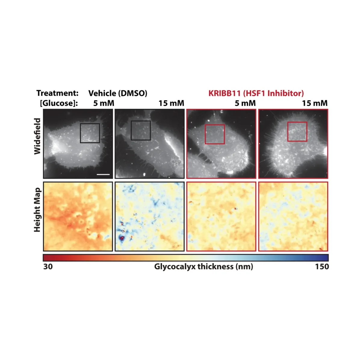 This figure shows the results of blocking a protein called heat shock factor 1. Using scanning angle interference microscopy, the scientists showed that inhibiting this protein prevented the thickening of the outer protective layer that cancer cells use to trick the immune system. Image credit: Kevin Tharp, Sanford Burnham Prebys.