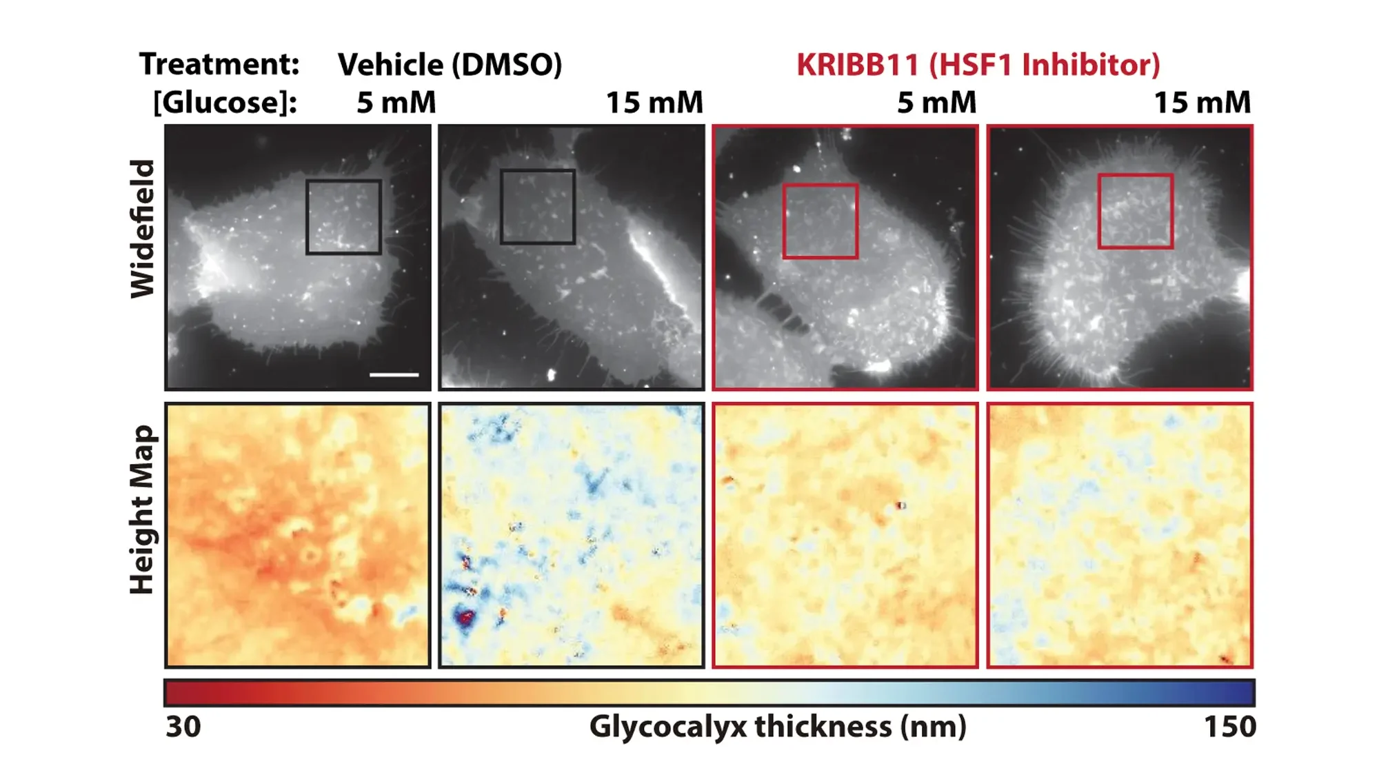 This figure shows the results of blocking a protein called heat shock factor 1. Using scanning angle interference microscopy, the scientists showed that inhibiting this protein prevented the thickening of the outer protective layer that cancer cells use to trick the immune system. Image credit: Kevin Tharp, Sanford Burnham Prebys.