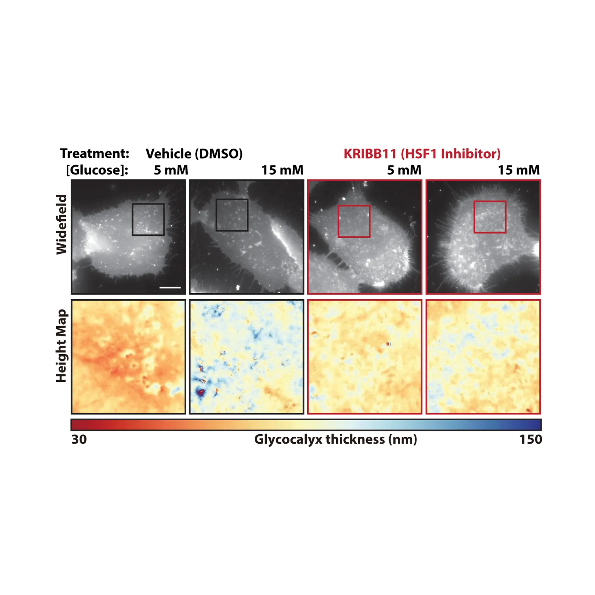 This figure shows the results of blocking a protein called heat shock factor 1. Using scanning angle interference microscopy, the scientists showed that inhibiting this protein prevented the thickening of the outer protective layer that cancer cells use to trick the immune system. Image credit: Kevin Tharp, Sanford Burnham Prebys.